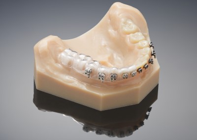 3D printed dental teeth models