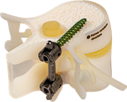 BoneMatrix - Medical BoneMatrix - Medical