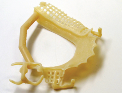 Iverson Dental Laboratories - PolyJet Case Study Iverson Dental Laboratories - PolyJet Case Study