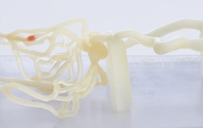 3D printed medical model made with digital anatomy materials